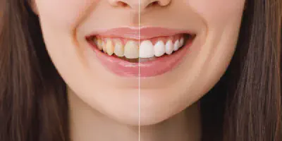 /img/32140-healthy-teeth.webp