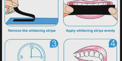 /img/32143-choosing-whitening-method.webp