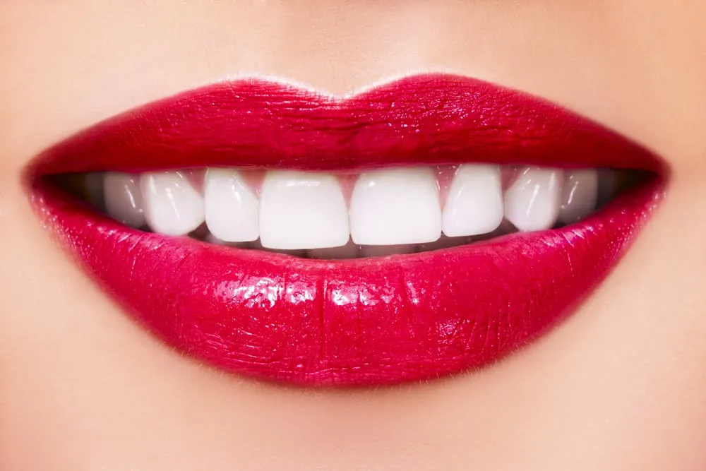 32145 at home teeth whitening