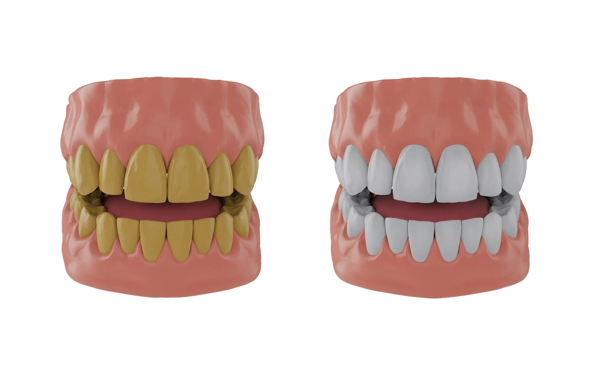 /img/32145-dental-checkup.webp