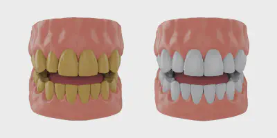 /img/32145-dental-checkup.webp
