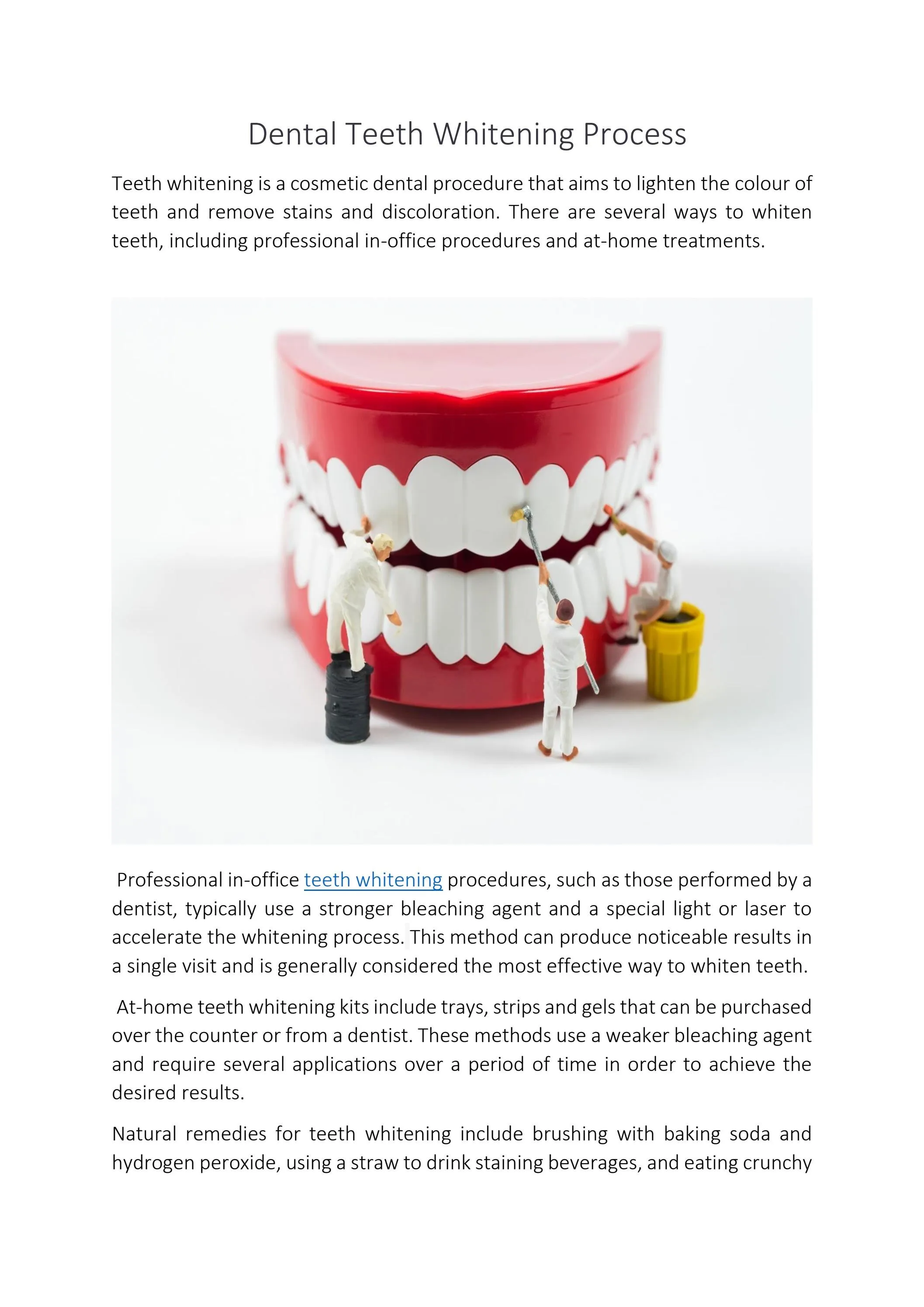 /img/32150-teeth-whitening-before-after.webp