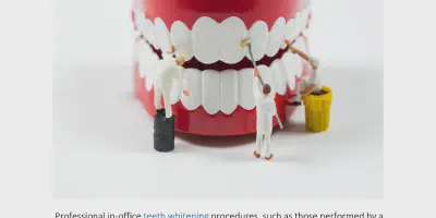 /img/32150-teeth-whitening-before-after.webp
