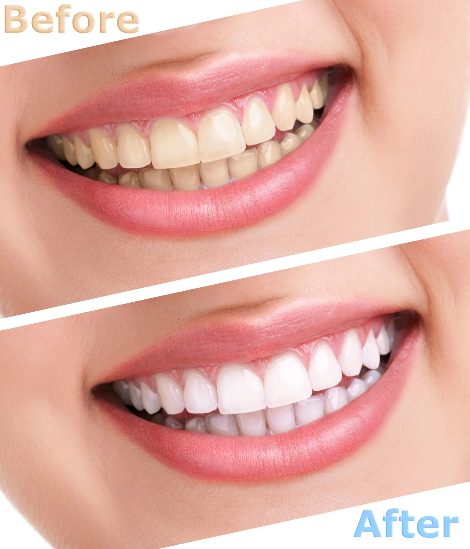 /img/32154-dentist-consultation.webp