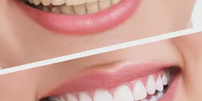 /img/32154-dentist-consultation.webp