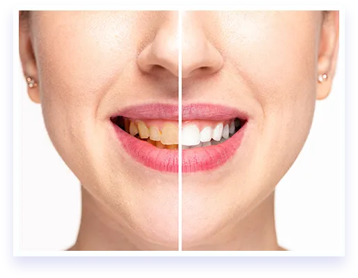 32159 whitening toothpaste
