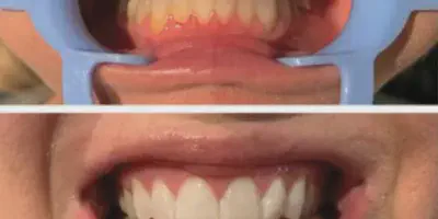 /img/32163-oral-hygiene.webp