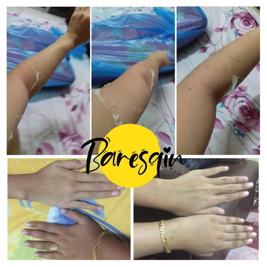 /img/32168-skin-whitening-alternatives.webp