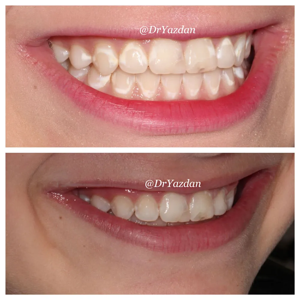 32169 consulting a dentist