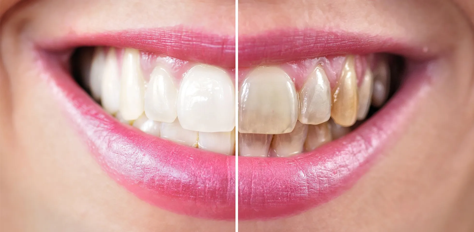 32169 maintaining oral hygiene