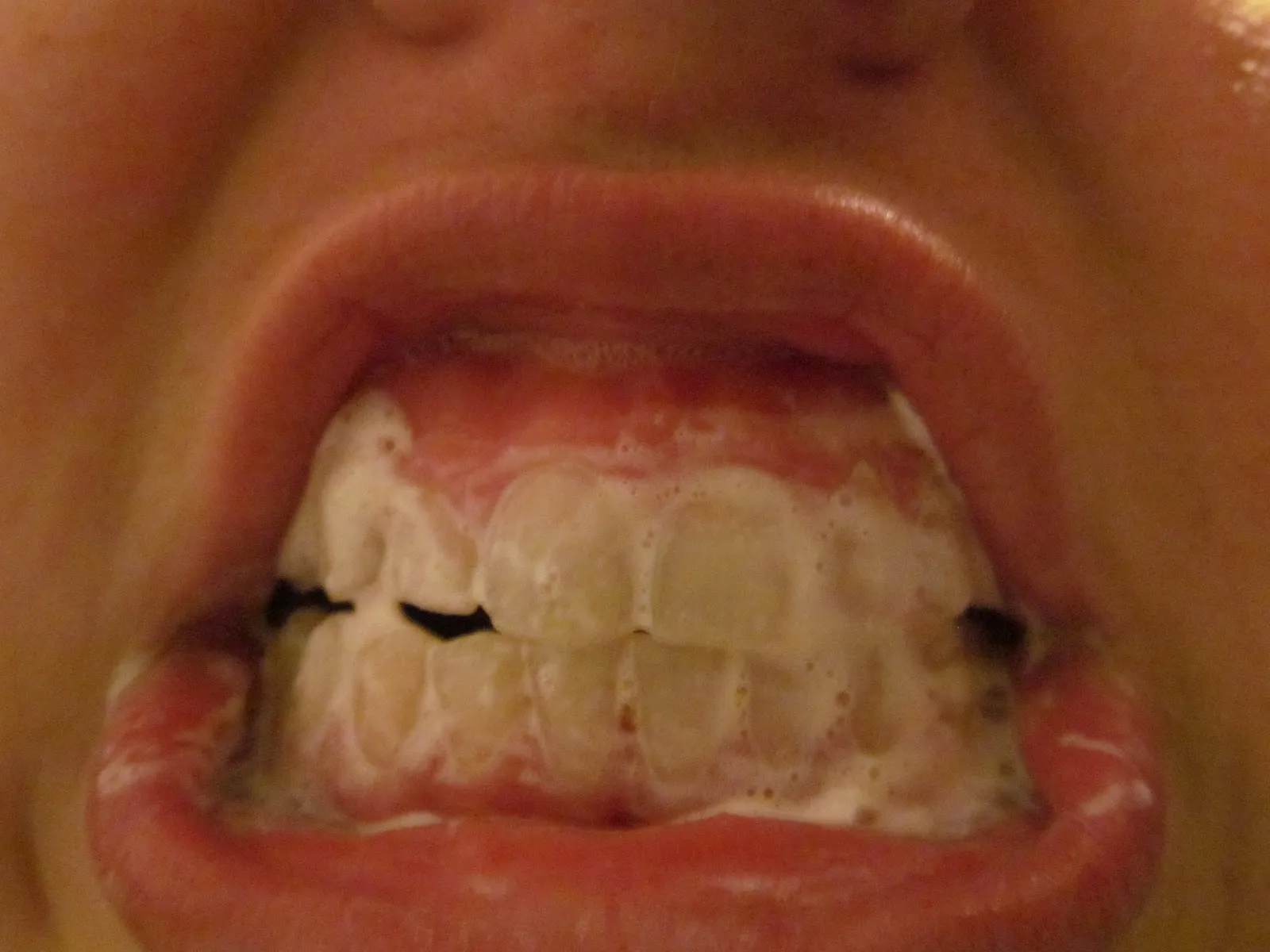 /img/32169-whitening-guide.webp
