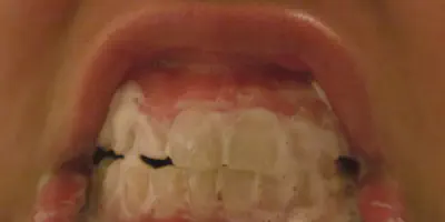 /img/32169-whitening-guide.webp