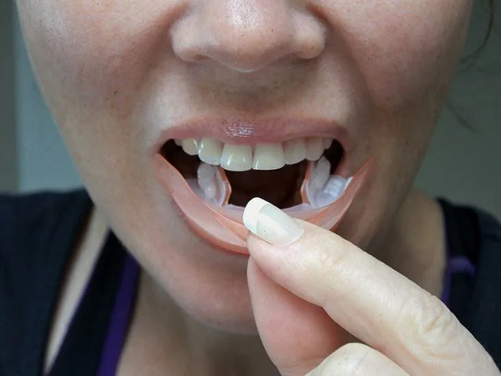 32170 oral cancer