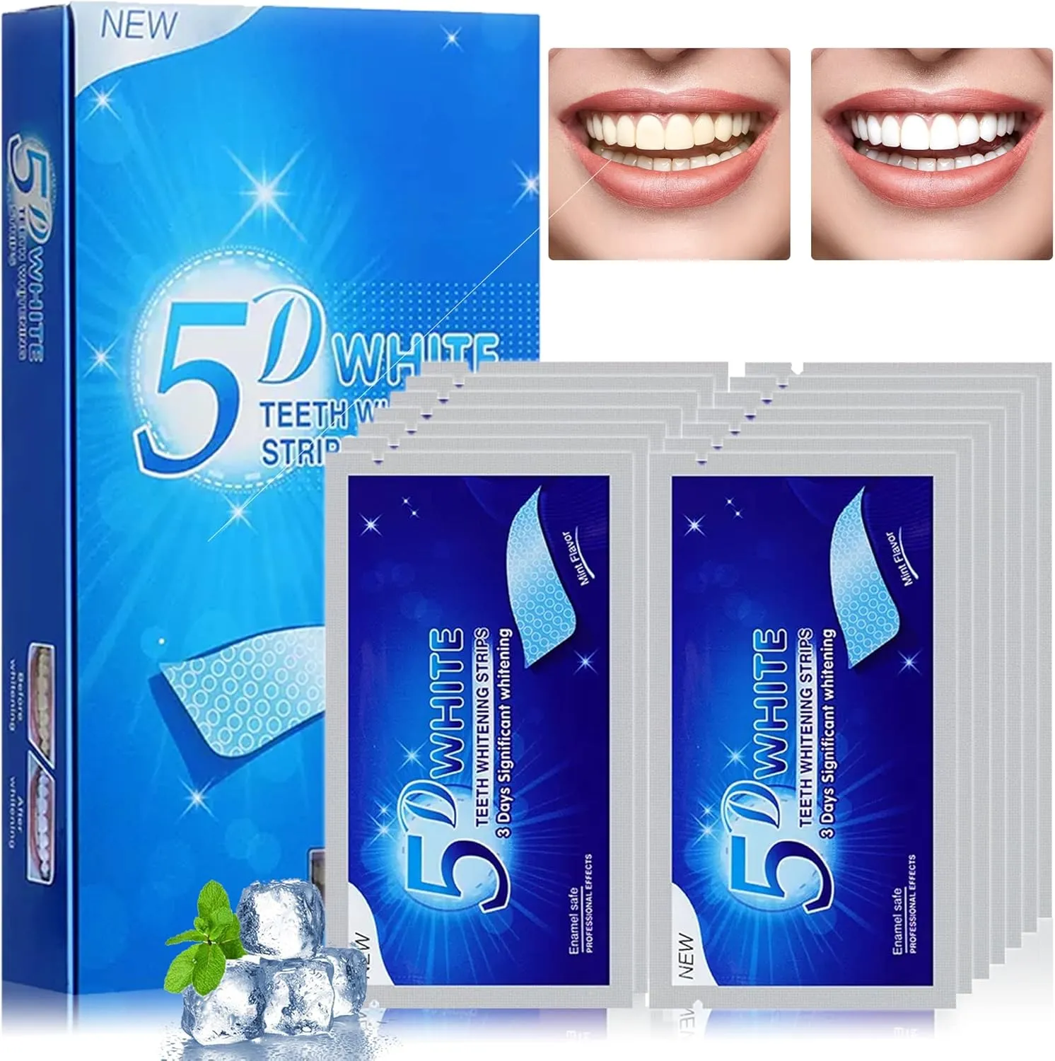 32170 tooth decay