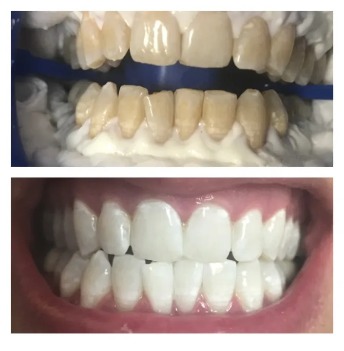 /img/32171-qualified-dentist-boca-raton.webp