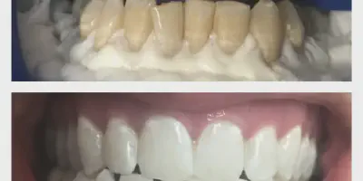 /img/32171-qualified-dentist-boca-raton.webp