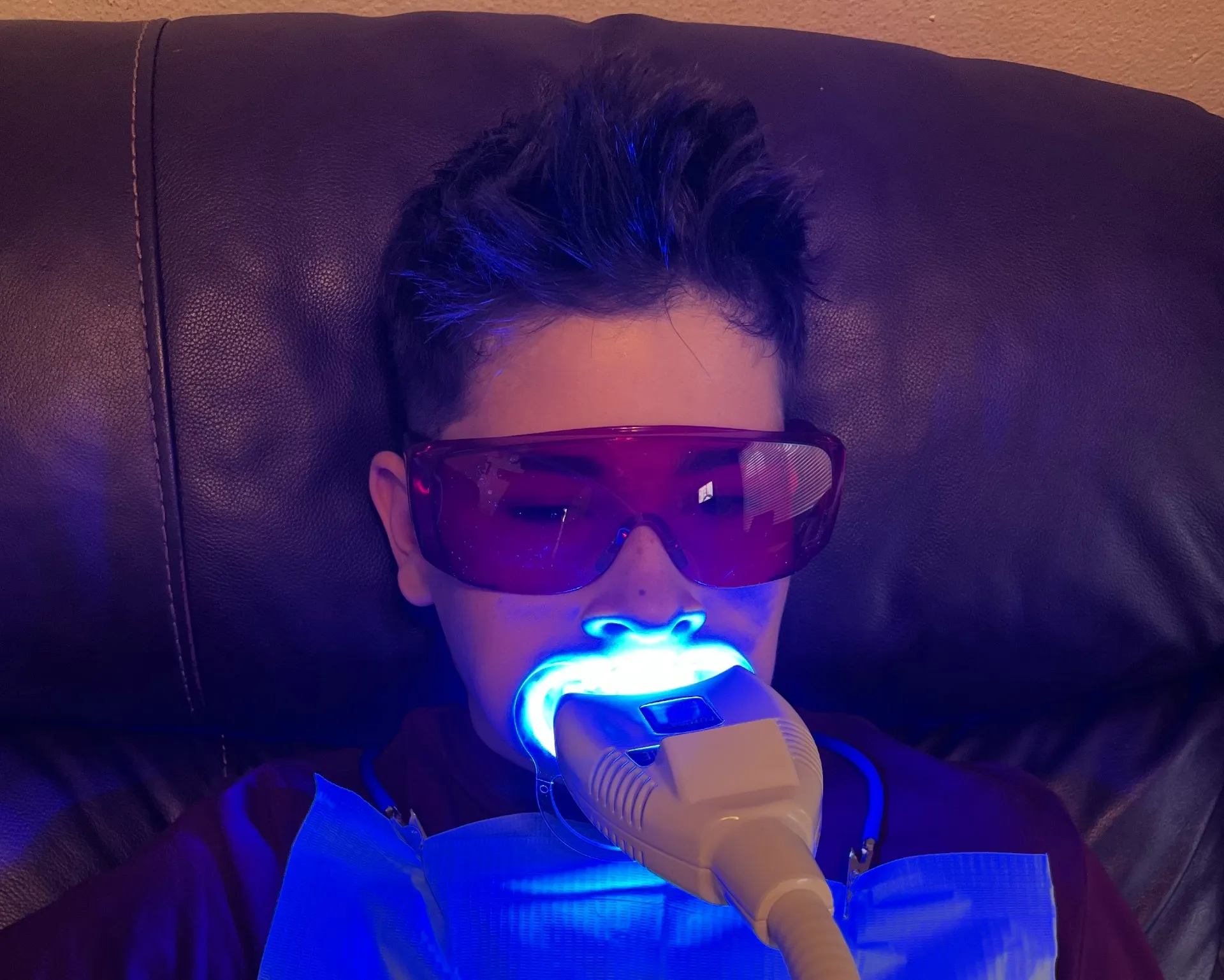 32174 teeth whitening toledo before after