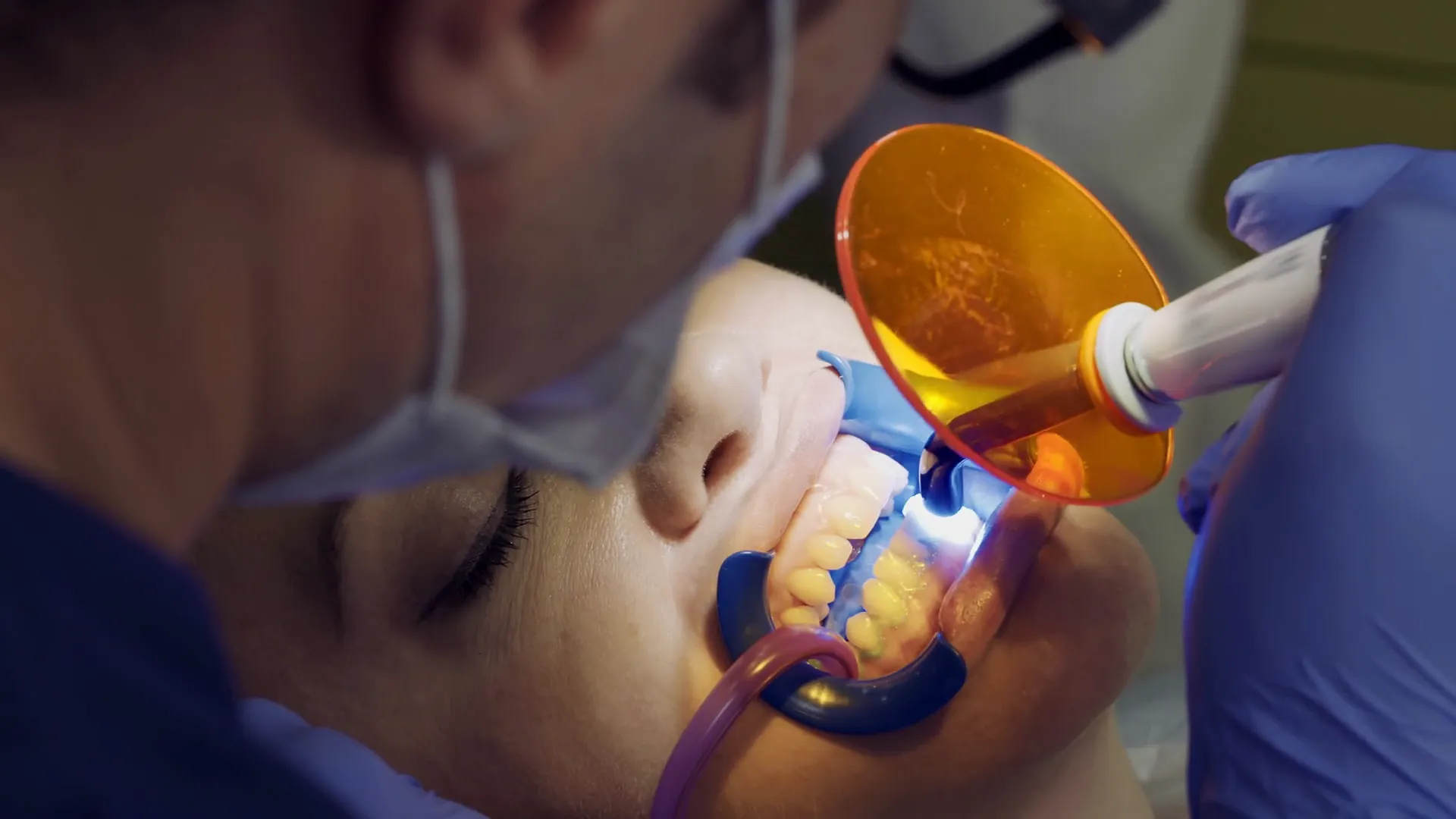 32182 teeth whitening results