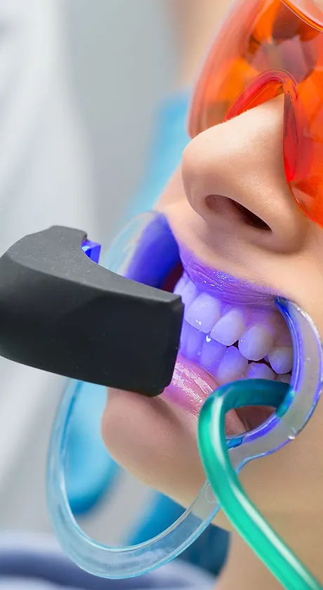 32184 zoom teeth whitening nyc 2