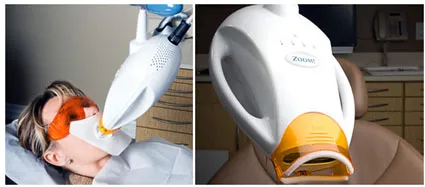 32184 zoom teeth whitening nyc 6