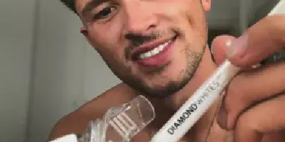 /img/32186-teeth-whitening-kuwait-7.webp