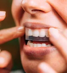 32187 take home teeth whitening kits