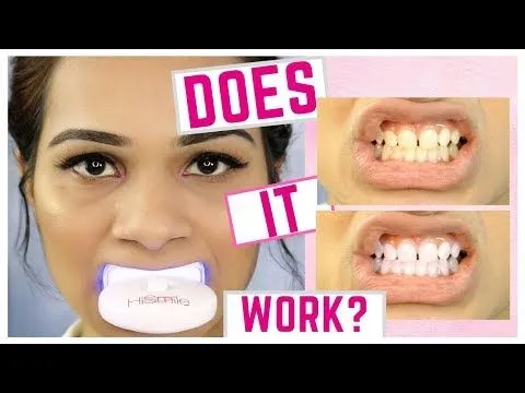 /img/32192-oral-hygiene-routine.webp