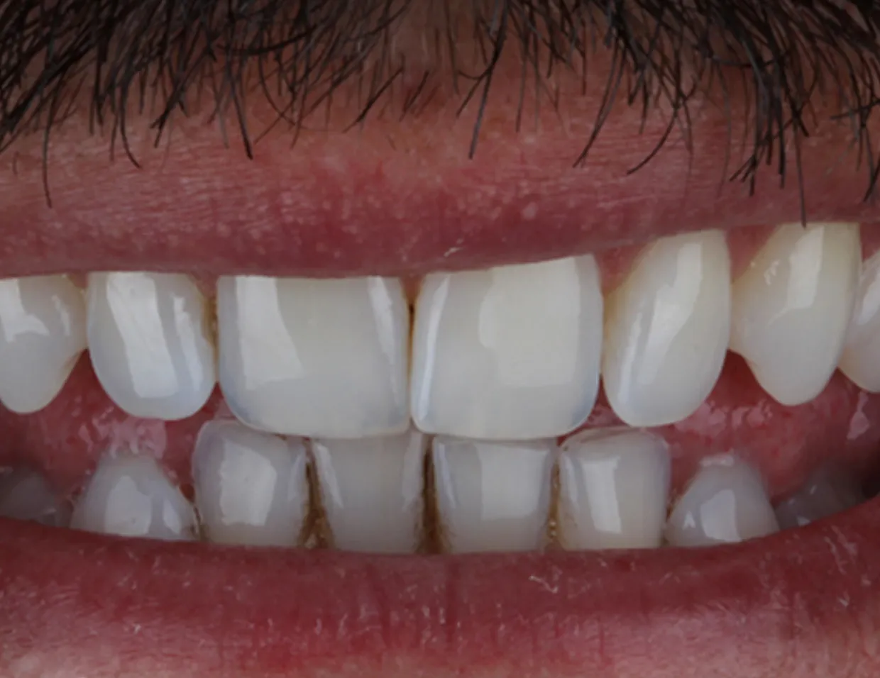/img/32194-smile-with-white-teeth.webp