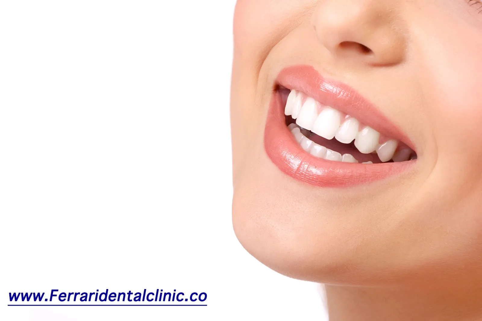 32194 teeth sensitivity whitening