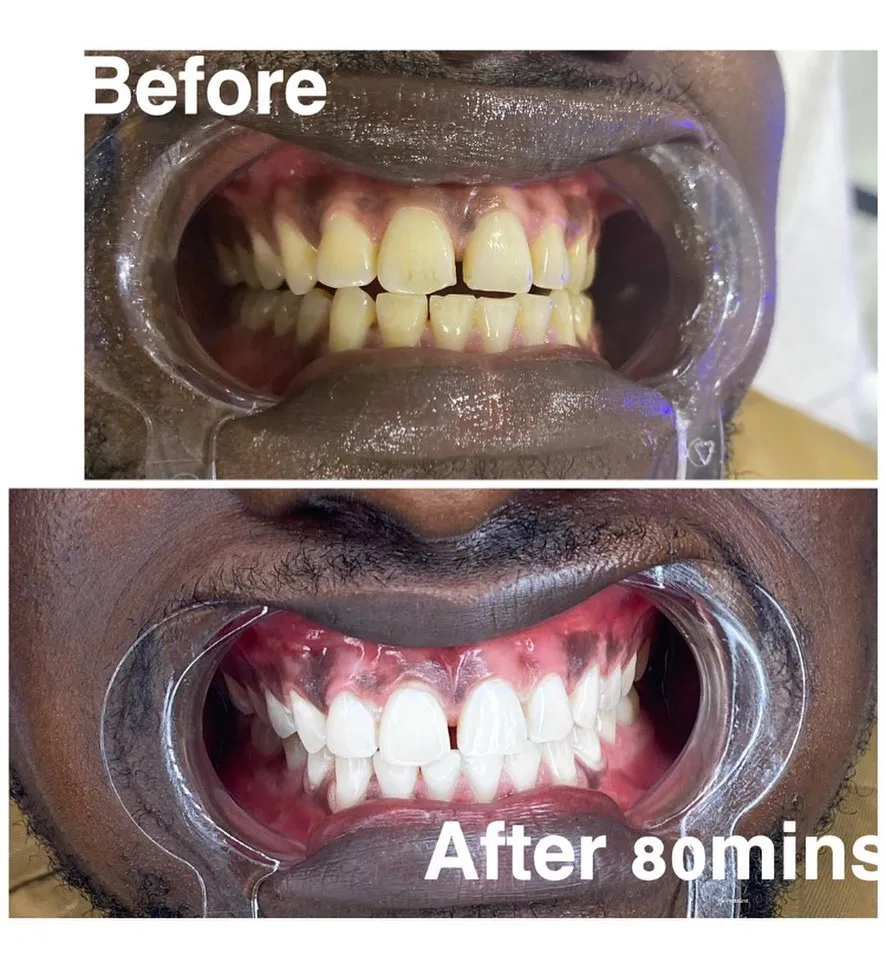 /img/32196-expert-supervision-whitening.webp