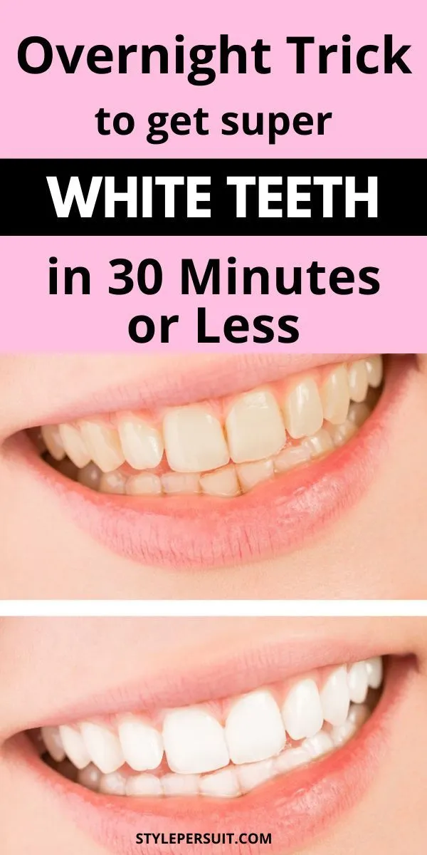 32197 teeth whitening image5