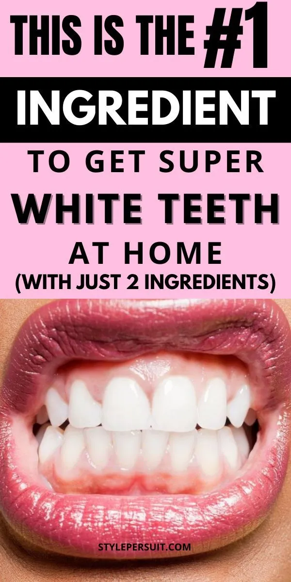 /img/32197-teeth-whitening-image7.webp