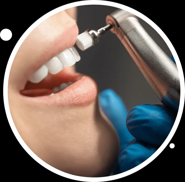 32202 teeth whitening lawrenceville ga cost