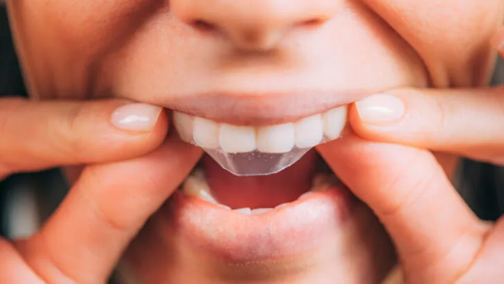 32203 whitening strips application