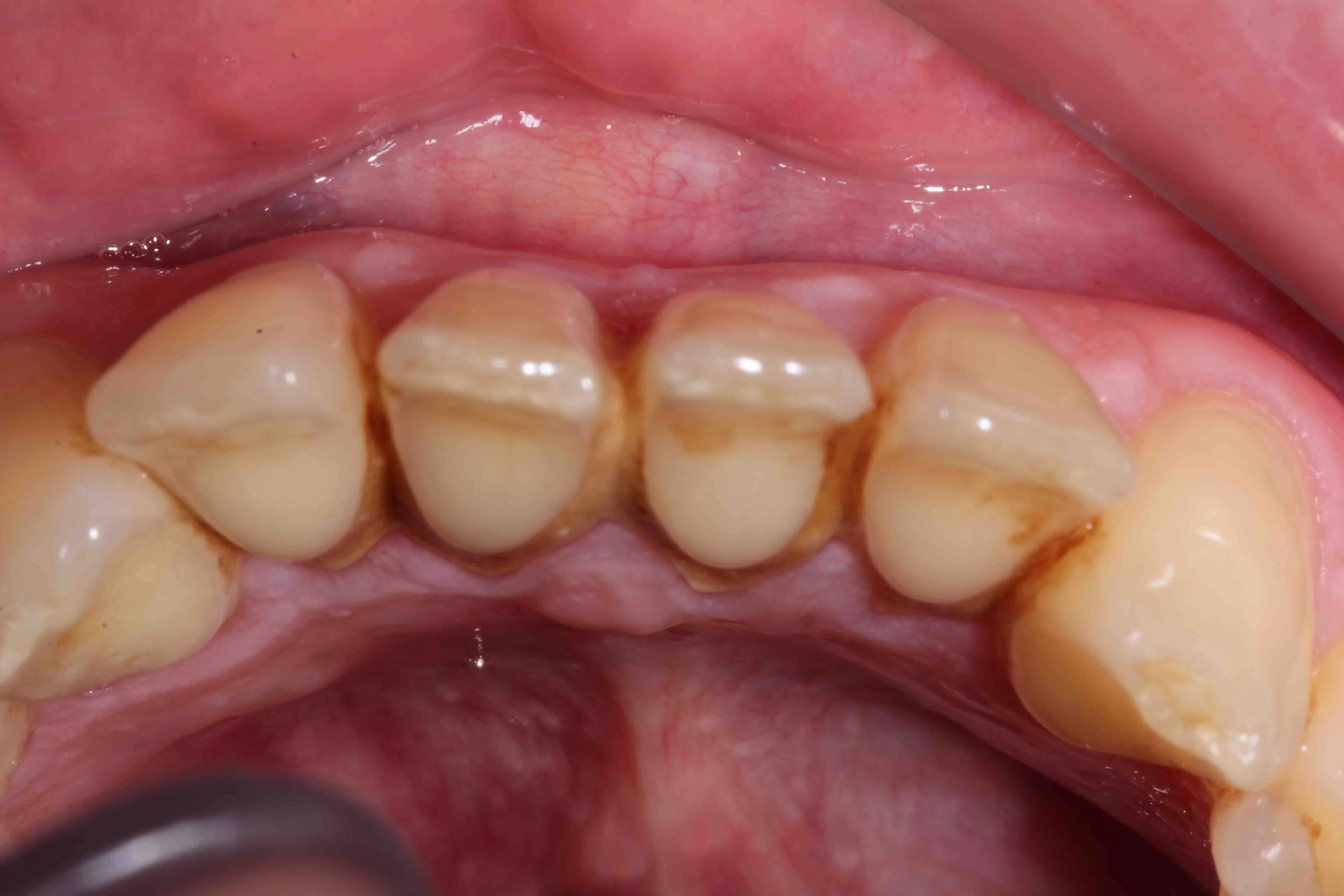 /img/32210-extending-whitening-results.webp