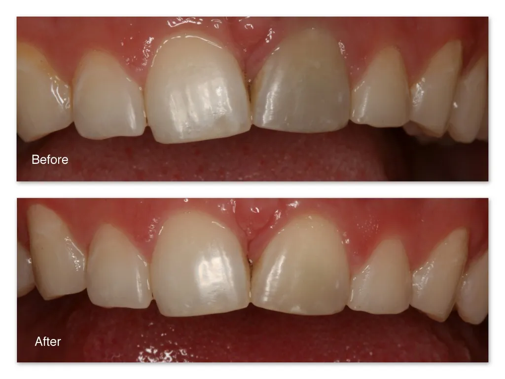 32210 oral hygiene practices