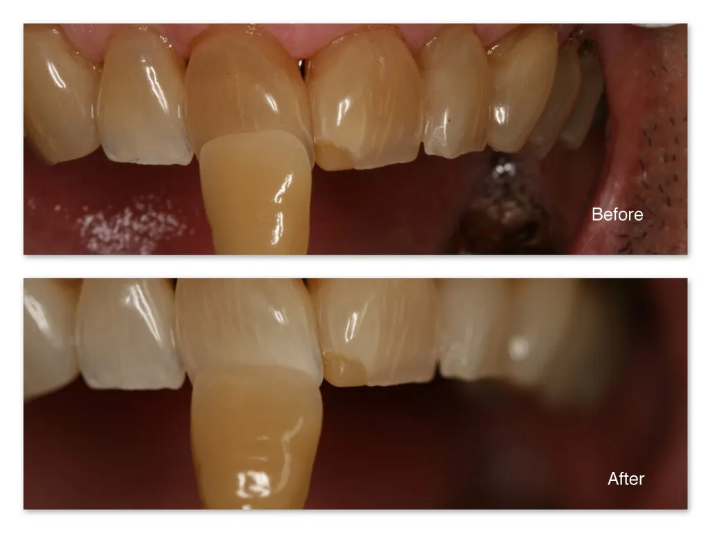 32210 regular dental checkups