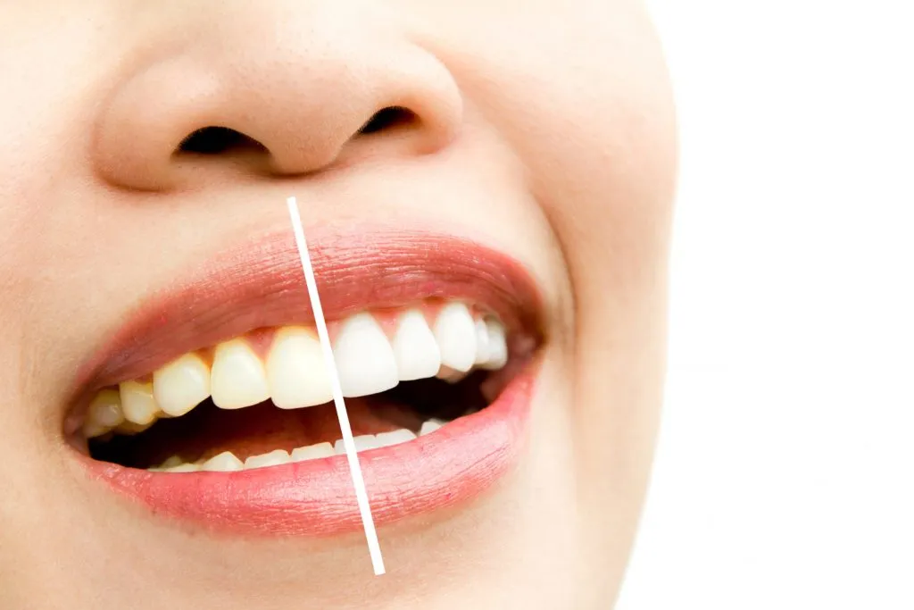 32211 teeth whitening strips
