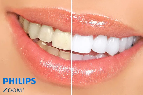 32213 whitening toothpastes