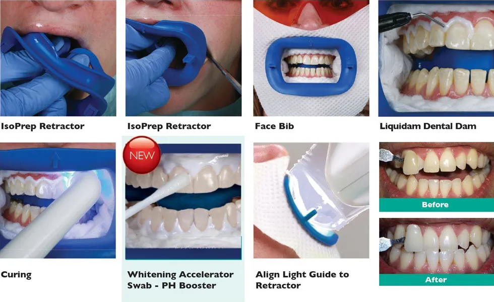 /img/32215-foods-that-stain-teeth.webp
