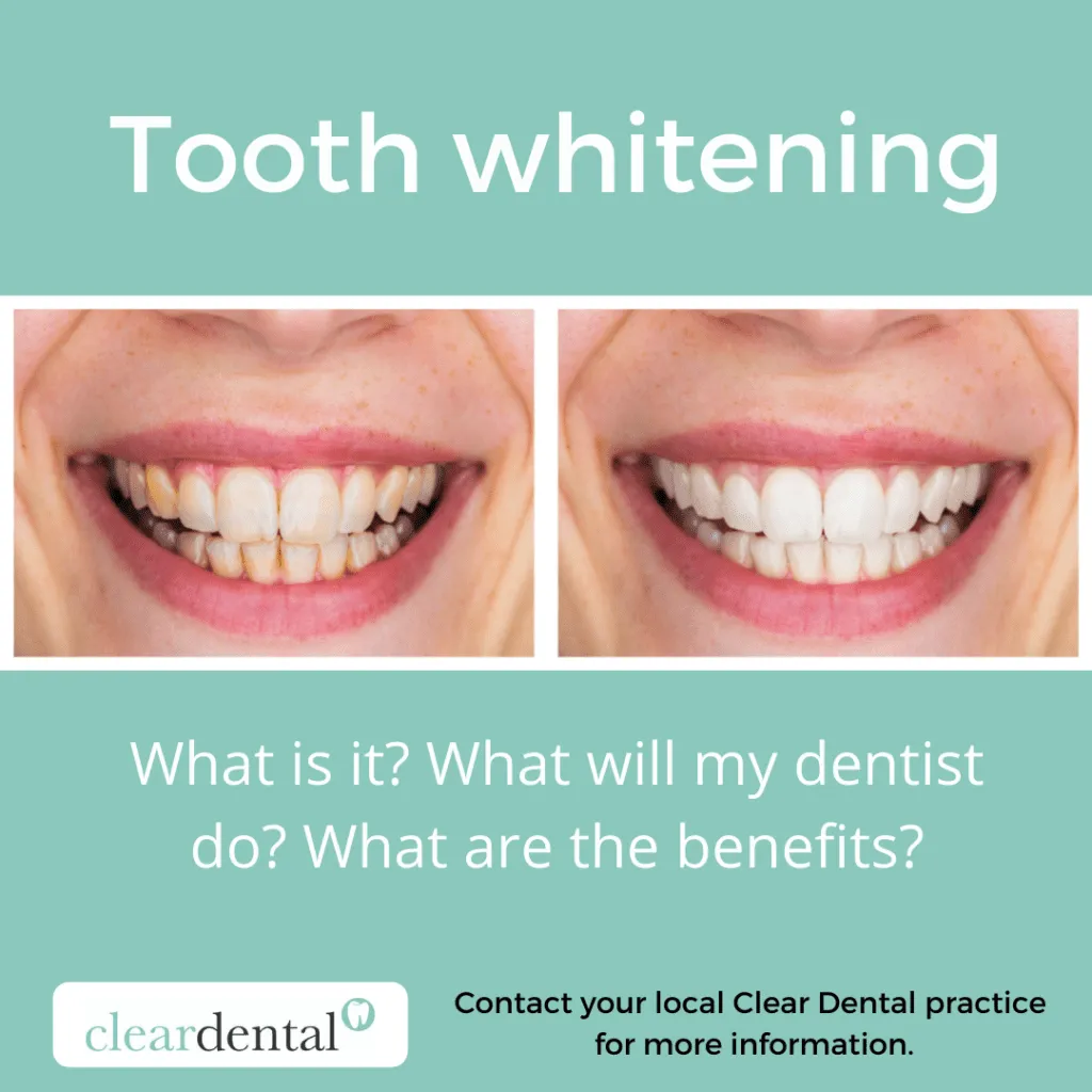32215 maintaining white smile