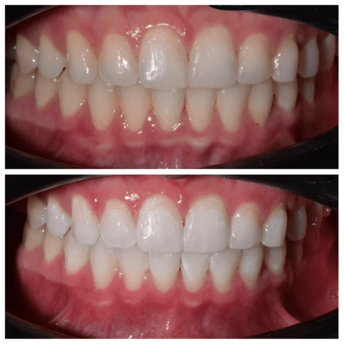 32217 dentist examining teeth