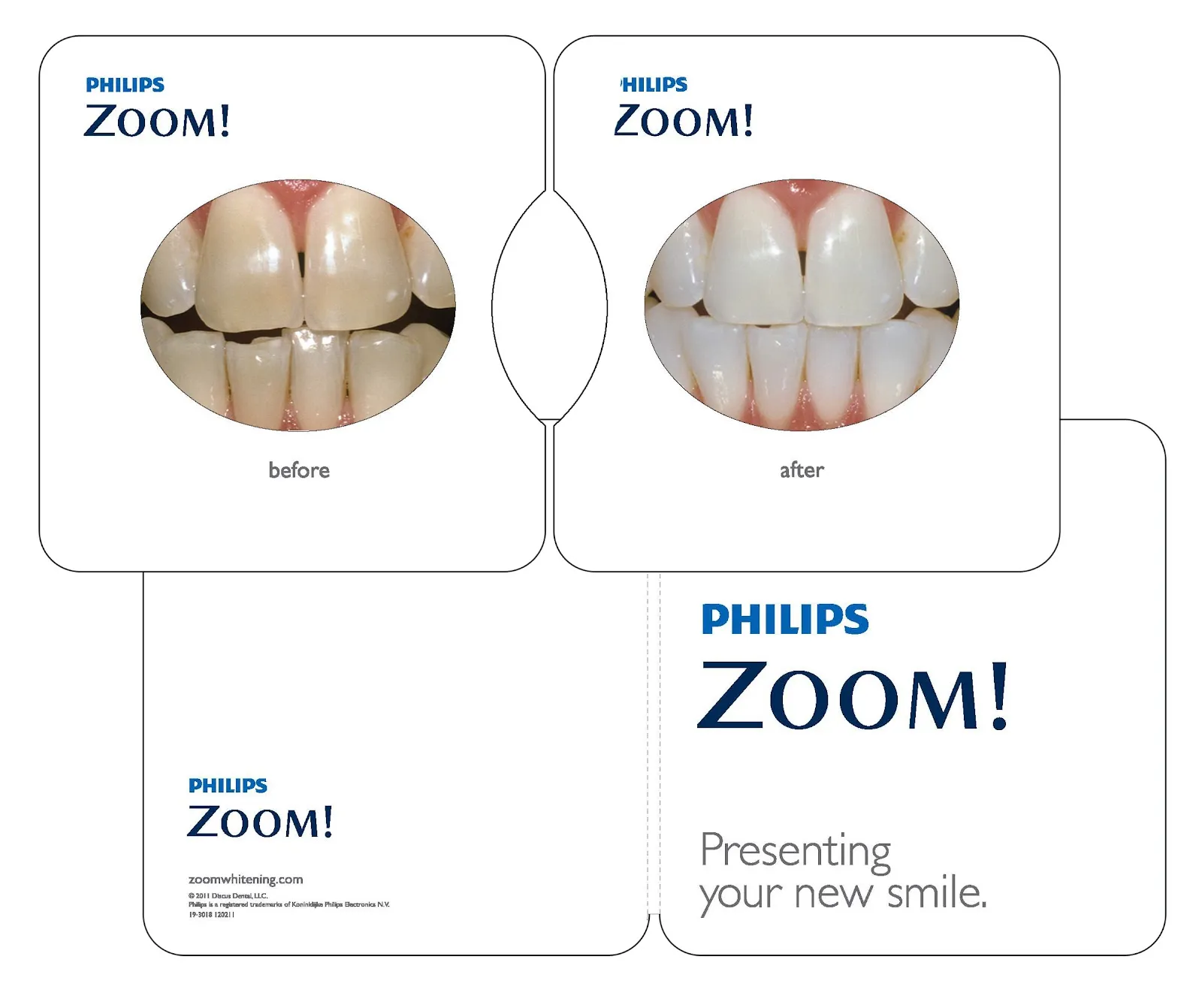 32217 zoom whitening comparison