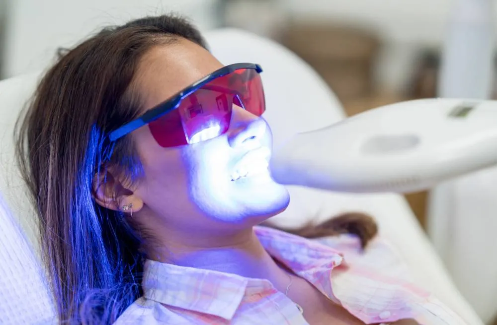 32219 laser teeth whitening
