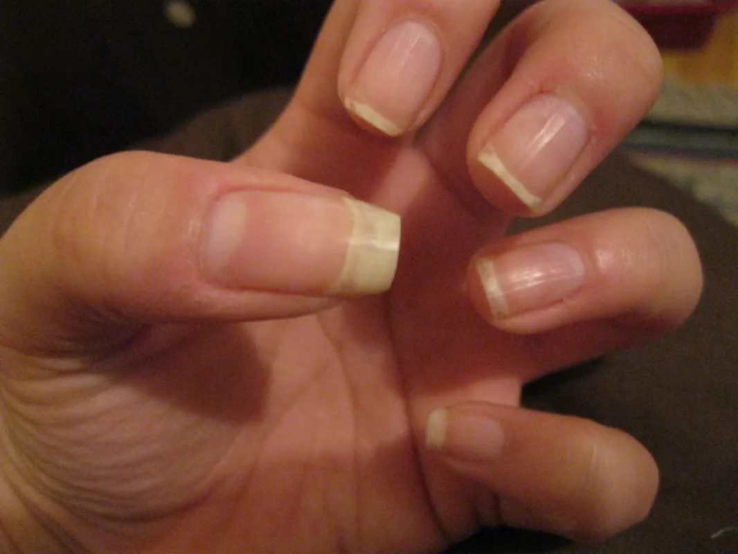 32221 baking soda nails