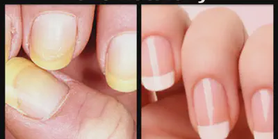 /img/32221-bright-nails.webp