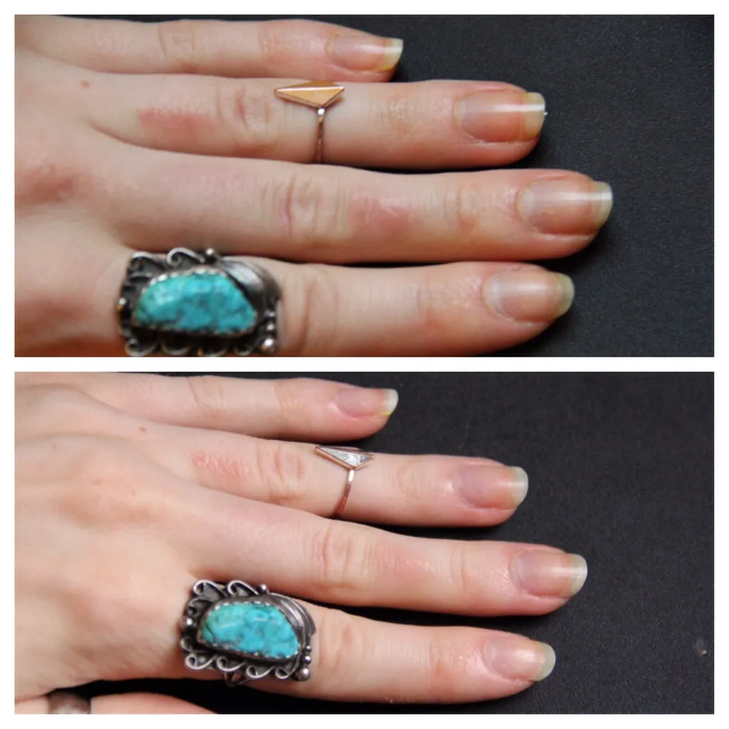 32221 healthy nails diet