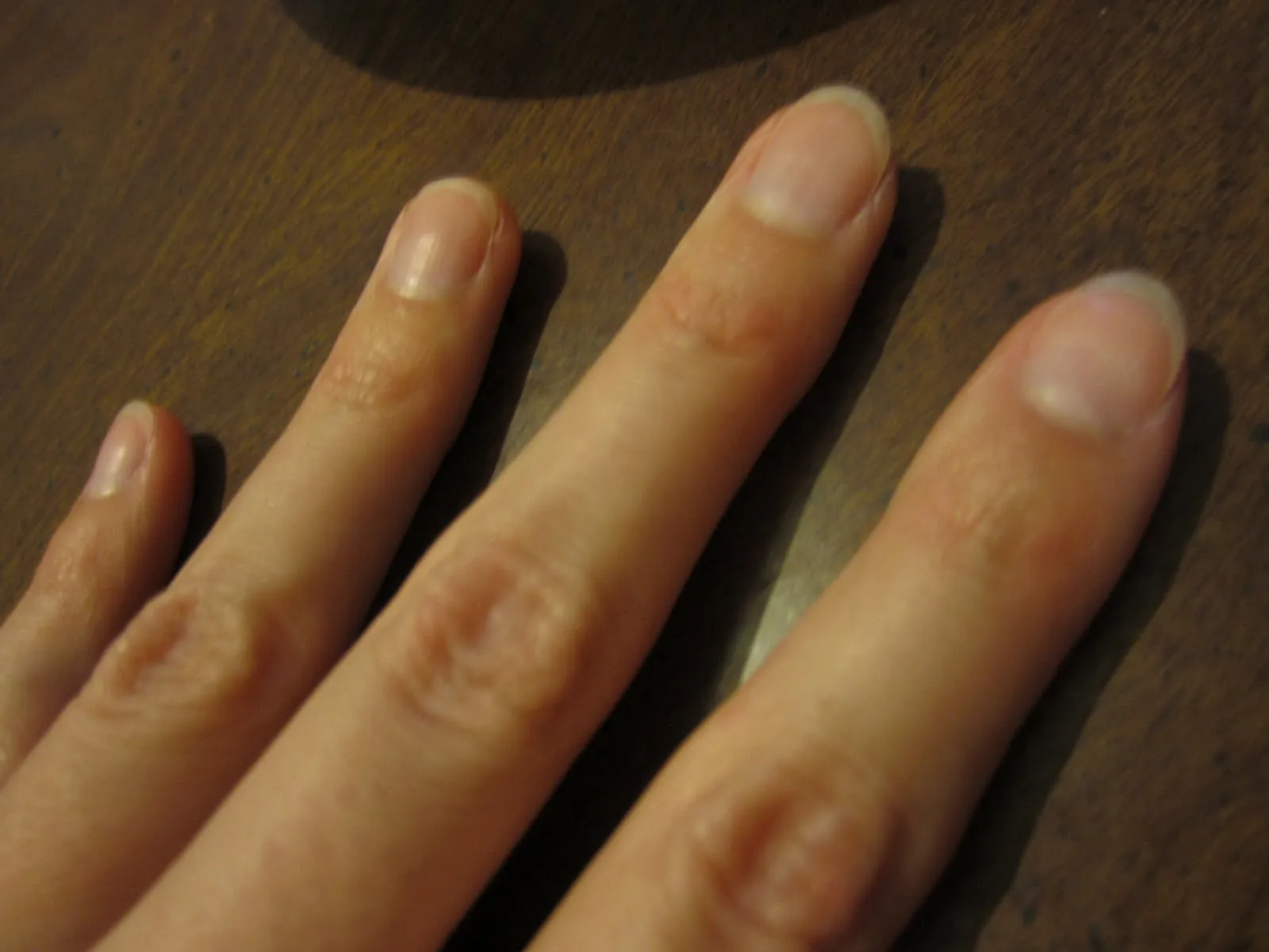 32221 hydrogen peroxide nails
