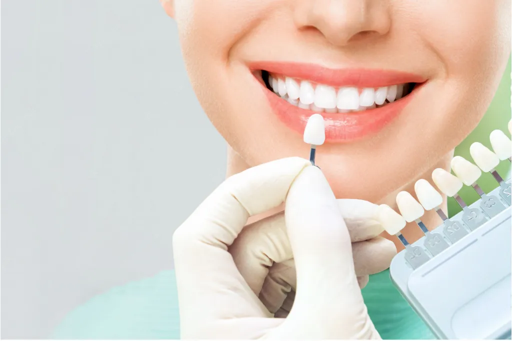 32223 teeth whitening equipment