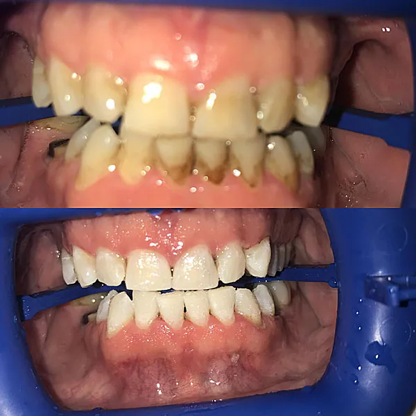 /img/32227-healthy-smile-teeth.webp